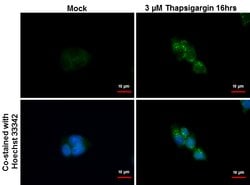 SQSTM1 Monoclonal Antibody (GT381), Invitrogen&trade;