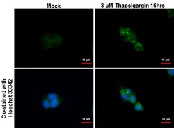 SQSTM1 Monoclonal Antibody (GT381), Invitrogen&trade;