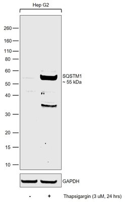 SQSTM1 Monoclonal Antibody (GT381), Invitrogen&trade;