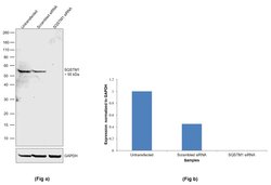 SQSTM1 Monoclonal Antibody (GT381), Invitrogen&trade;