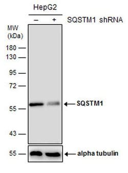 SQSTM1 Monoclonal Antibody (GT381), Invitrogen&trade;