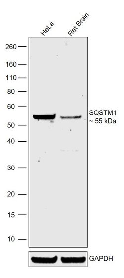 SQSTM1 Monoclonal Antibody (GT381), Invitrogen&trade;