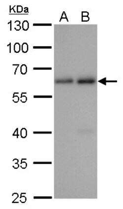 SQSTM1 Monoclonal Antibody (GT381), Invitrogen&trade;