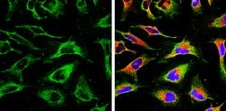 Invitrogen Calnexin Monoclonal Antibody (GT1563) 100 &mu;L; Unconjugated:Antibodies,