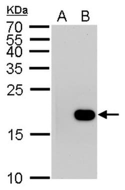 Invitrogen Phospho-Histone H3 (Ser10) Monoclonal Antibody (GT921) 100 &mu;L;