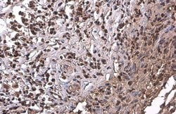 Invitrogen PRMT1 Monoclonal Antibody (GT10111) 100 &mu;L; Unconjugated:Antibodies,