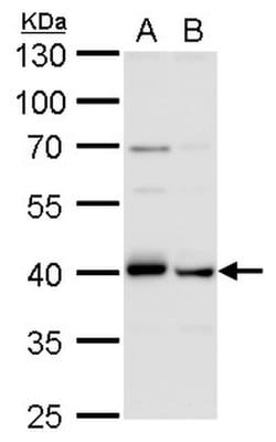 Invitrogen TDP-43 Monoclonal Antibody (GT225) 100 &mu;L; Unconjugated:Antibodies,