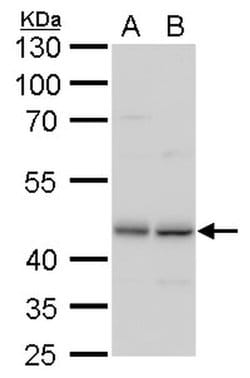 Invitrogen TDP-43 Monoclonal Antibody (GT225) 100 &mu;L; Unconjugated:Antibodies,