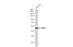 Invitrogen ENO1 Monoclonal Antibody (GT186) 100 &mu;L; Unconjugated:Antibodies,