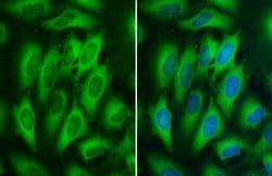 Invitrogen MEK2 Monoclonal Antibody (GT1721) 100 &mu;L; Unconjugated:Antibodies,
