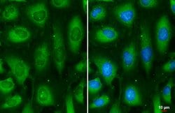 Invitrogen MEK2 Monoclonal Antibody (GT3522) 100 &mu;L; Unconjugated:Antibodies,