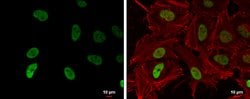 Invitrogen H3K9ac Monoclonal Antibody (GT464) 100 &mu;L; Unconjugated:Antibodies,