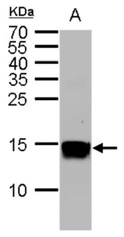Invitrogen H3K36me2 Monoclonal Antibody (GT1488) 100 &mu;L | Buy Online | Invitrogen&trade; | Fisher Scientific