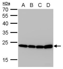 Invitrogen SOD2 Monoclonal Antibody (GT582) 100 &mu;L | Buy Online | Invitrogen&trade; | Fisher Scientific