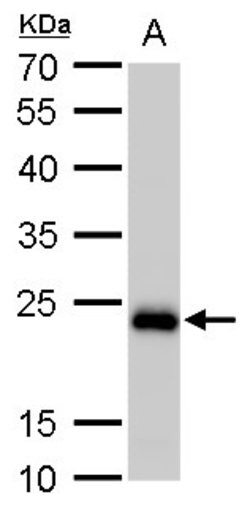 Invitrogen SOD2 Monoclonal Antibody (GT582) 100 &mu;L | Buy Online | Invitrogen&trade; | Fisher Scientific