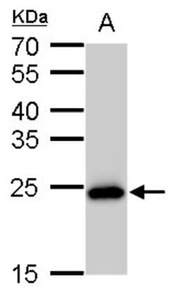 Invitrogen SOD2 Monoclonal Antibody (GT582) 100 &mu;L | Buy Online | Invitrogen&trade; | Fisher Scientific