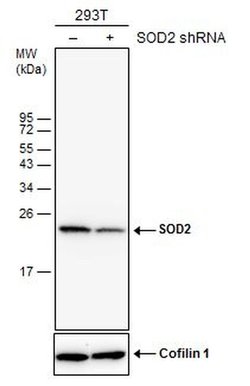 Invitrogen SOD2 Monoclonal Antibody (GT582) 100 &mu;L | Buy Online | Invitrogen&trade; | Fisher Scientific