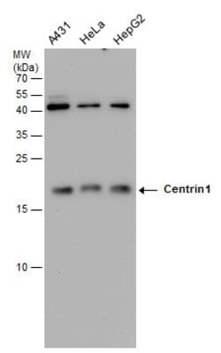 Centrin 1 Monoclonal Antibody (GT147):Antibodies, Monoclonal