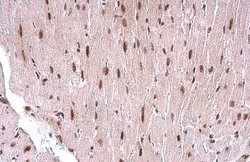 Invitrogen TDG Monoclonal Antibody (GT1511) 100 &mu;L; Unconjugated:Antibodies,