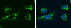 Invitrogen Glutaminase C (GAC) Monoclonal Antibody (GT1075) 100 &mu;L;