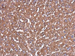 Invitrogen Glutaminase C (GAC) Monoclonal Antibody (GT3211) 100 &mu;L | Buy Online | Invitrogen&trade; | Fisher Scientific