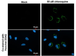 Invitrogen LC3B Monoclonal Antibody (GT3612) 100 &mu;L; Unconjugated:Antibodies,