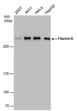Invitrogen Filamin B Monoclonal Antibody (GT1282) 100 &mu;L; Unconjugated:Antibodies,