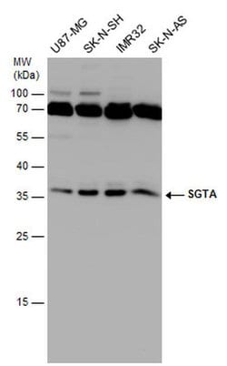 Invitrogen SGTA Monoclonal Antibody (6A4) 100 &mu;L; Unconjugated:Antibodies,