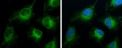Invitrogen ACSL4 Monoclonal Antibody (GT186) 100 &mu;L; Unconjugated:Antibodies,