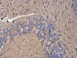 Invitrogen ACSL4 Monoclonal Antibody (GT186) 100 &mu;L; Unconjugated:Antibodies,