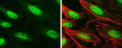 BRG1 Monoclonal Antibody (GT2712):Antibodies, Monoclonal