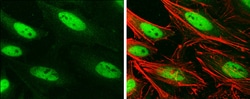 BRG1 Monoclonal Antibody (GT2712):Antibodies, Monoclonal