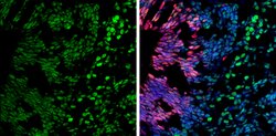 BRG1 Monoclonal Antibody (GT2712):Antibodies, Monoclonal