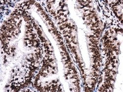 BRG1 Monoclonal Antibody (GT2712):Antibodies, Monoclonal