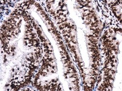 BRG1 Monoclonal Antibody (GT2712):Antibodies, Monoclonal