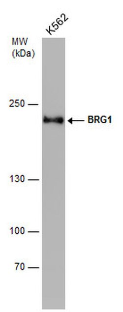 BRG1 Monoclonal Antibody (GT2712):Antibodies, Monoclonal