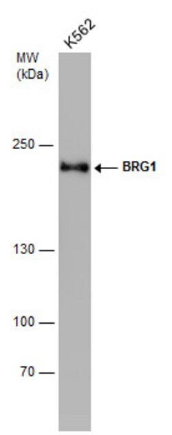 BRG1 Monoclonal Antibody (GT2712):Antibodies, Monoclonal