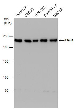 BRG1 Monoclonal Antibody (GT2712):Antibodies, Monoclonal