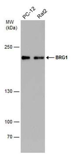 BRG1 Monoclonal Antibody (GT2712):Antibodies, Monoclonal