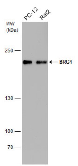 BRG1 Monoclonal Antibody (GT2712):Antibodies, Monoclonal