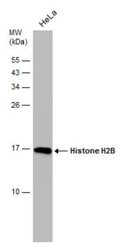 Histone H2B Monoclonal Antibody (GT387):Antibodies, Monoclonal