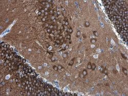 PYK2 Monoclonal Antibody (GT1132):Antibodies, Monoclonal