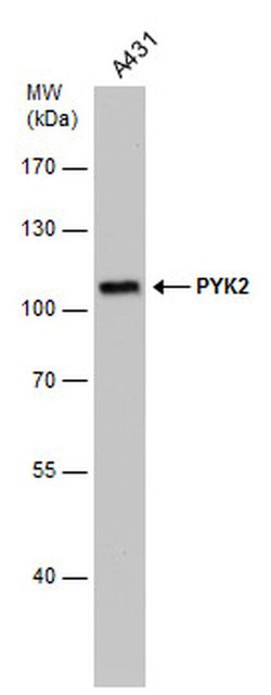 PYK2 Monoclonal Antibody (GT1132):Antibodies, Monoclonal
