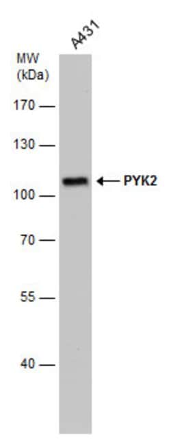 PYK2 Monoclonal Antibody (GT1132):Antibodies, Monoclonal