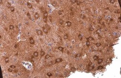 Invitrogen PYK2 Monoclonal Antibody (GT858) 100 &mu;L; Unconjugated:Antibodies,