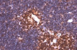 Invitrogen PYK2 Monoclonal Antibody (GT858) 100 &mu;L; Unconjugated:Antibodies,