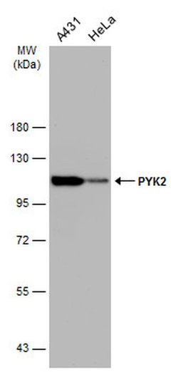 Invitrogen PYK2 Monoclonal Antibody (GT858) 100 &mu;L; Unconjugated:Antibodies,
