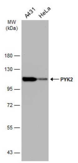 Invitrogen PYK2 Monoclonal Antibody (GT858) 100 &mu;L; Unconjugated:Antibodies,
