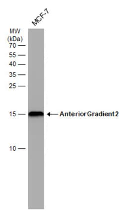 Invitrogen AGR2 Monoclonal Antibody (GT5812) 100 &mu;L | Buy Online | Invitrogen&trade; | Fisher Scientific