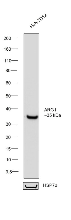 Invitrogen Arginase 1 Monoclonal Antibody (GT5811) 100 &mu;L | Buy Online | Invitrogen&trade; | Fisher Scientific